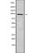 Transient Receptor Potential Cation Channel Subfamily V Member 3 antibody, abx219147, Abbexa, Western Blot image 