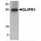 GLI Pathogenesis Related 1 antibody, MBS153334, MyBioSource, Western Blot image 