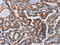 Phospholipase C Beta 3 antibody, CSB-PA906272, Cusabio, Immunohistochemistry paraffin image 