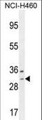 WBSCR27 antibody, LS-C160569, Lifespan Biosciences, Western Blot image 