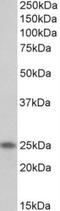 Troponin I1, Slow Skeletal Type antibody, NBP2-26202, Novus Biologicals, Western Blot image 