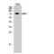 LIM Domain Kinase 1 antibody, LS-C384353, Lifespan Biosciences, Western Blot image 