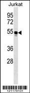 Tryptophanyl-TRNA Synthetase antibody, 59-659, ProSci, Western Blot image 