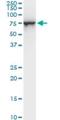 Stress Induced Phosphoprotein 1 antibody, H00010963-M06, Novus Biologicals, Western Blot image 