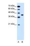 Solute Carrier Family 35 Member B1 antibody, NBP1-69299, Novus Biologicals, Western Blot image 