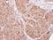 Baculoviral IAP Repeat Containing 3 antibody, GTX113128, GeneTex, Immunohistochemistry paraffin image 