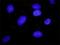 Arrestin Beta 2 antibody, H00000409-M01, Novus Biologicals, Proximity Ligation Assay image 