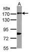 CD11b antibody, GTX113089, GeneTex, Western Blot image 