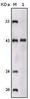 Sortilin Related Receptor 1 antibody, GTX83063, GeneTex, Western Blot image 