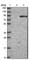 Glucuronidase Beta antibody, HPA036322, Atlas Antibodies, Western Blot image 