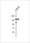 Leucine Rich Pentatricopeptide Repeat Containing antibody, 61-290, ProSci, Western Blot image 