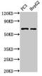 PARP2 antibody, LS-C675066, Lifespan Biosciences, Western Blot image 
