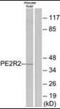 Prostaglandin E Receptor 2 antibody, orb95049, Biorbyt, Western Blot image 