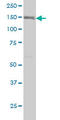 Integrin Subunit Alpha 2 antibody, LS-C197550, Lifespan Biosciences, Western Blot image 
