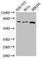Propionyl-CoA Carboxylase Subunit Alpha antibody, LS-C682225, Lifespan Biosciences, Western Blot image 