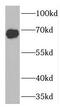 FA Complementation Group G antibody, FNab03008, FineTest, Western Blot image 