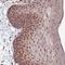 CDC Like Kinase 3 antibody, NBP1-91794, Novus Biologicals, Immunohistochemistry paraffin image 