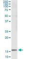 SH2 Domain Containing 1B antibody, H00117157-M04, Novus Biologicals, Immunoprecipitation image 