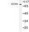 Lysine Acetyltransferase 2A antibody, LS-C177130, Lifespan Biosciences, Western Blot image 