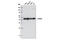 Beta-Actin antibody, 12262S, Cell Signaling Technology, Western Blot image 