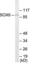 SRY-Box 6 antibody, EKC1715, Boster Biological Technology, Western Blot image 