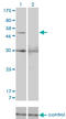 Matrix Metallopeptidase 13 antibody, LS-C197693, Lifespan Biosciences, Western Blot image 