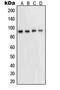 Signal Transducer And Activator Of Transcription 5A antibody, LS-C352893, Lifespan Biosciences, Western Blot image 