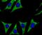 Cytochrome P450 Family 17 Subfamily A Member 1 antibody, NBP2-75461, Novus Biologicals, Immunofluorescence image 