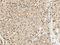 Glial Cell Derived Neurotrophic Factor antibody, LS-C773413, Lifespan Biosciences, Immunohistochemistry paraffin image 