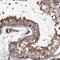 THAP Domain Containing 9 antibody, NBP1-93848, Novus Biologicals, Immunohistochemistry paraffin image 