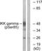 Inhibitor Of Nuclear Factor Kappa B Kinase Regulatory Subunit Gamma antibody, TA311838, Origene, Western Blot image 
