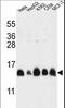 Histone Cluster 1 H2A Family Member M antibody, LS-C166891, Lifespan Biosciences, Western Blot image 