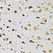 G Protein-Coupled Receptor Kinase 2 antibody, LS-C331619, Lifespan Biosciences, Immunohistochemistry paraffin image 