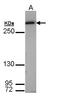 FAS antibody, LS-C186103, Lifespan Biosciences, Western Blot image 