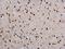 Twist Family BHLH Transcription Factor 1 antibody, PA5-78211, Invitrogen Antibodies, Immunohistochemistry frozen image 