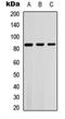 Serum/Glucocorticoid Regulated Kinase 1 antibody, LS-C358307, Lifespan Biosciences, Western Blot image 