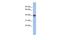 Insulin Induced Gene 1 antibody, GTX47438, GeneTex, Western Blot image 