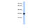 Sushi Domain Containing 3 antibody, 27-025, ProSci, Western Blot image 