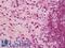 Chromodomain Helicase DNA Binding Protein 1 antibody, LS-B12654, Lifespan Biosciences, Immunohistochemistry paraffin image 