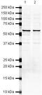SUFU Negative Regulator Of Hedgehog Signaling antibody, PA5-19555, Invitrogen Antibodies, Western Blot image 
