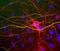 Neurofilament Light antibody, NBP1-05219, Novus Biologicals, Immunocytochemistry image 