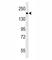 Platelet Derived Growth Factor Receptor Beta antibody, F53576-0.1ML, NSJ Bioreagents, Western Blot image 