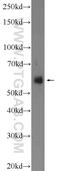 Solute Carrier Family 17 Member 6 antibody, 25261-1-AP, Proteintech Group, Western Blot image 