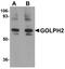Golgi Membrane Protein 1 antibody, A02975, Boster Biological Technology, Western Blot image 