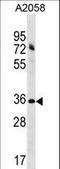 Acyl-CoA Binding Domain Containing 6 antibody, LS-C160992, Lifespan Biosciences, Western Blot image 