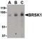 BR Serine/Threonine Kinase 1 antibody, PA5-20353, Invitrogen Antibodies, Western Blot image 