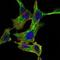 Component Of Inhibitor Of Nuclear Factor Kappa B Kinase Complex antibody, MA5-15696, Invitrogen Antibodies, Immunofluorescence image 