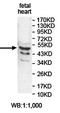 ZFP69 Zinc Finger Protein B antibody, orb78323, Biorbyt, Western Blot image 