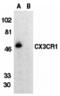 C-X3-C Motif Chemokine Receptor 1 antibody, 2201, QED Bioscience, Western Blot image 