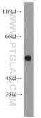 Docking Protein 3 antibody, 15749-1-AP, Proteintech Group, Western Blot image 